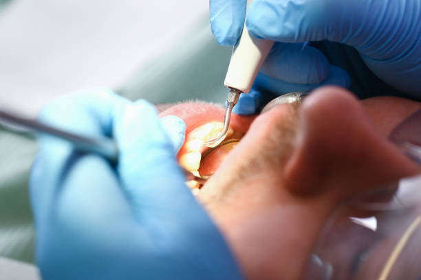 Best Pediatric Emergency Dentist in Vandalia, MO